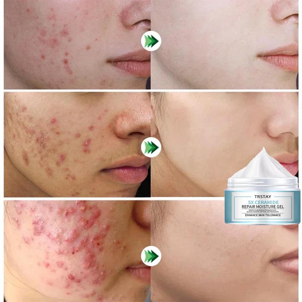 Retinol Moisturizing Face Cream, Mild and Non Irritating, Moisturizes, Brightens Skin Tone, and Makes Skin Soft and Delicate