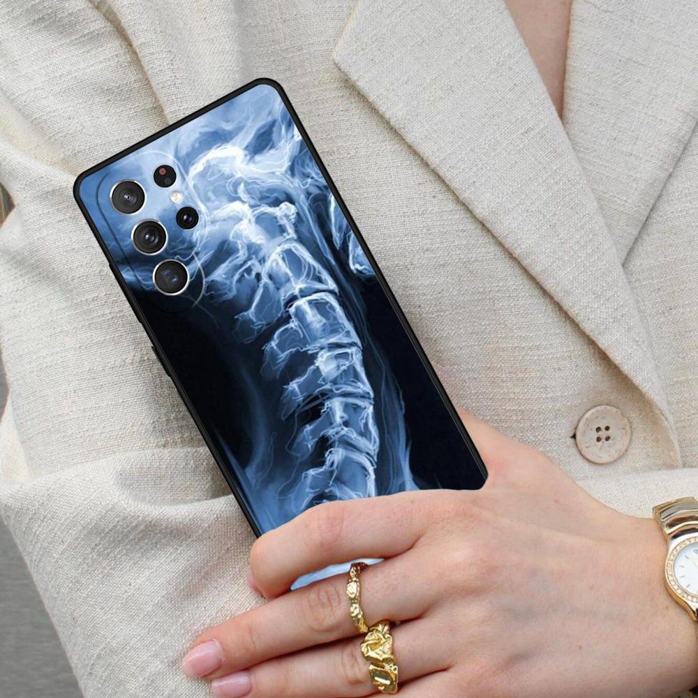 Skeleton X-Ray Cell Phone Case for Samsung Galaxy S26 Ultra S25 S24 S23 S22 S21 S20 Note10 Cover