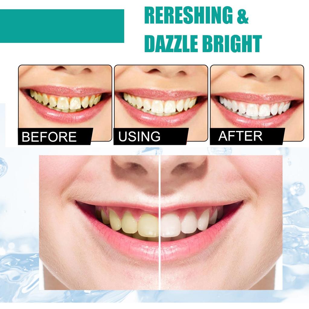 EELHOE Polvere Bianca per Denti 5 Giorni Rimuovi Placca Tartaro Pulisci Macchie Gialle dei Denti Polvere Pulizia Denti Alito Fresco 50g