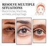 Wiyun Retinol Collagen Eye Cream  Reduces Dark Circles And Eye Bags, Moisturizing, Firming, Multi-Effect Eye Care Cream