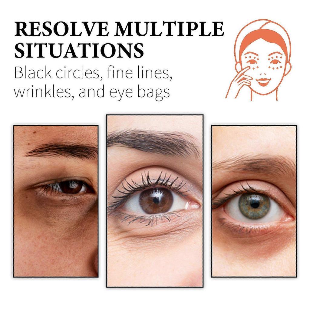 Wiyun Retinol Collagen Eye Cream Reduces Dark Circles And Eye Bags, Moisturizing, Firming, Multi-Effect Eye Care Cream
