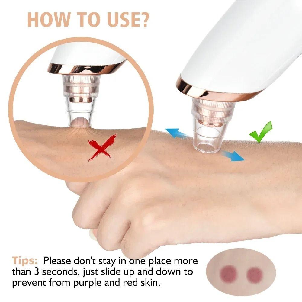 Deep Cleansing Electric Blackhead Remover 5 Suction Heads Blackhead Suction Device  Face Skin Care