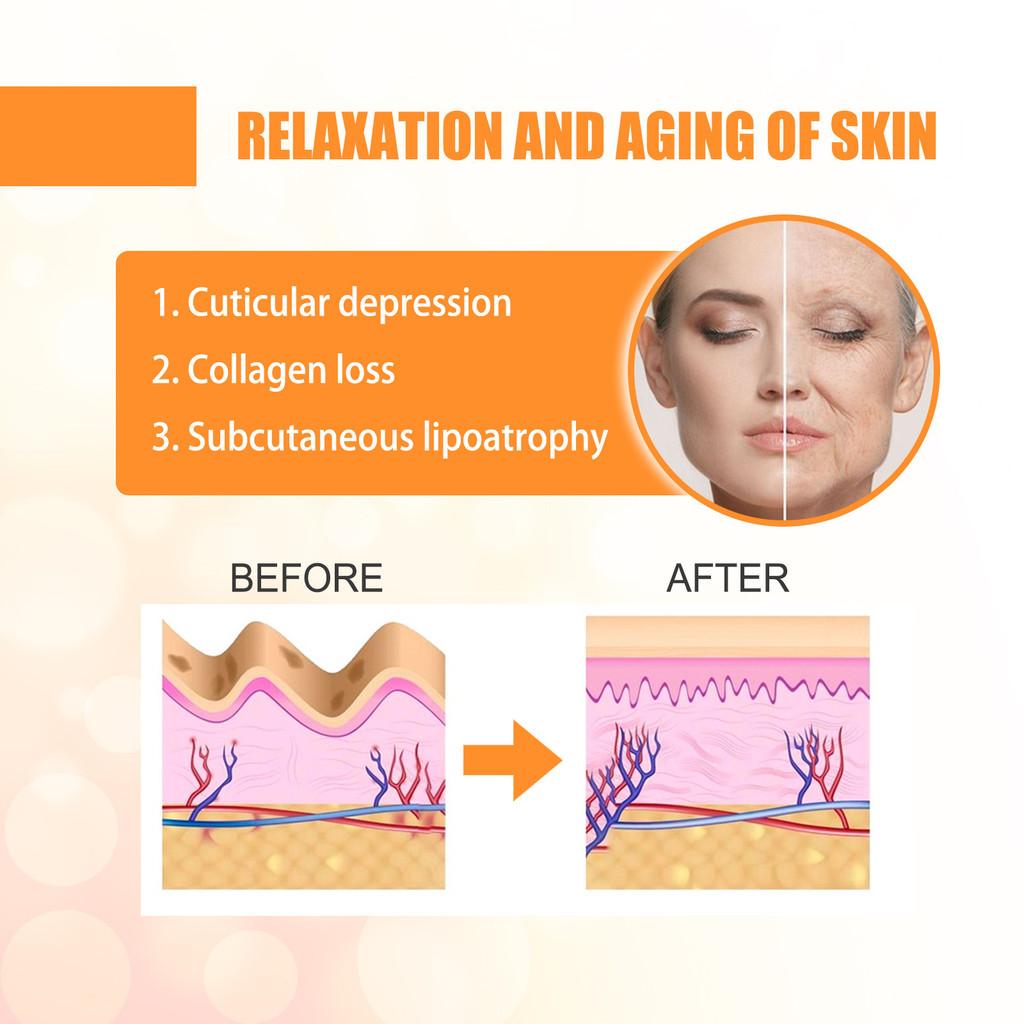 Eelhoe Collagen Water Soluble Wrinkle Patches For Deep Hydration And Skin Tightening