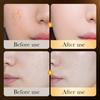 Zozu 24k Gold Hyaluronic Acid Hydrating Repair Essence Liquid For All Skin Types