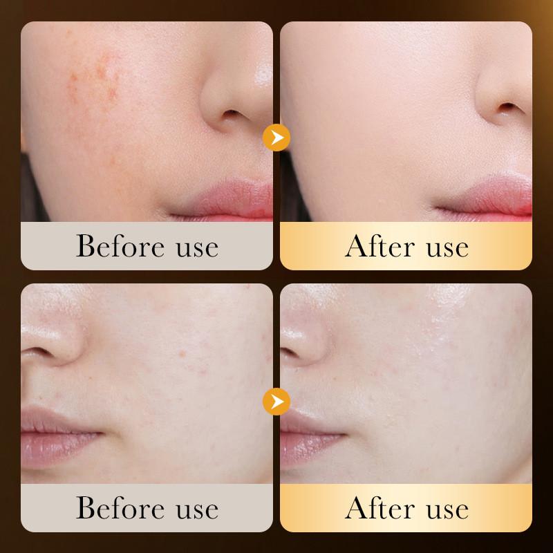 Zozu 24k Gold Hyaluronic Acid Hydrating Repair Essence Liquid For All Skin Types