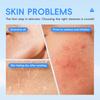 LAIKOU Hyaluronic Acid Collagen Facial Cleanser 50g Cleanses Pores and Hydrate