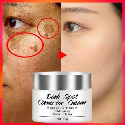 La más nueva crema correctora de manchas oscuras, crema facial blanqueadora, repara las pecas, elimina las manchas oscuras, removedor de melanina, crema facial iluminadora