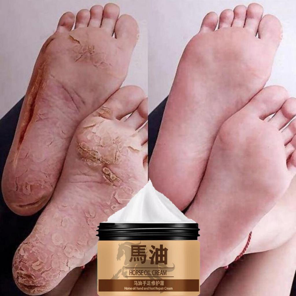 Ma You Hand and Foot Repair Cream doplňuje vlhkost, opravuje poškozenou pokožku nohou, obnovuje zdravou pokožku nohou a hydratuje a chrání nohy.