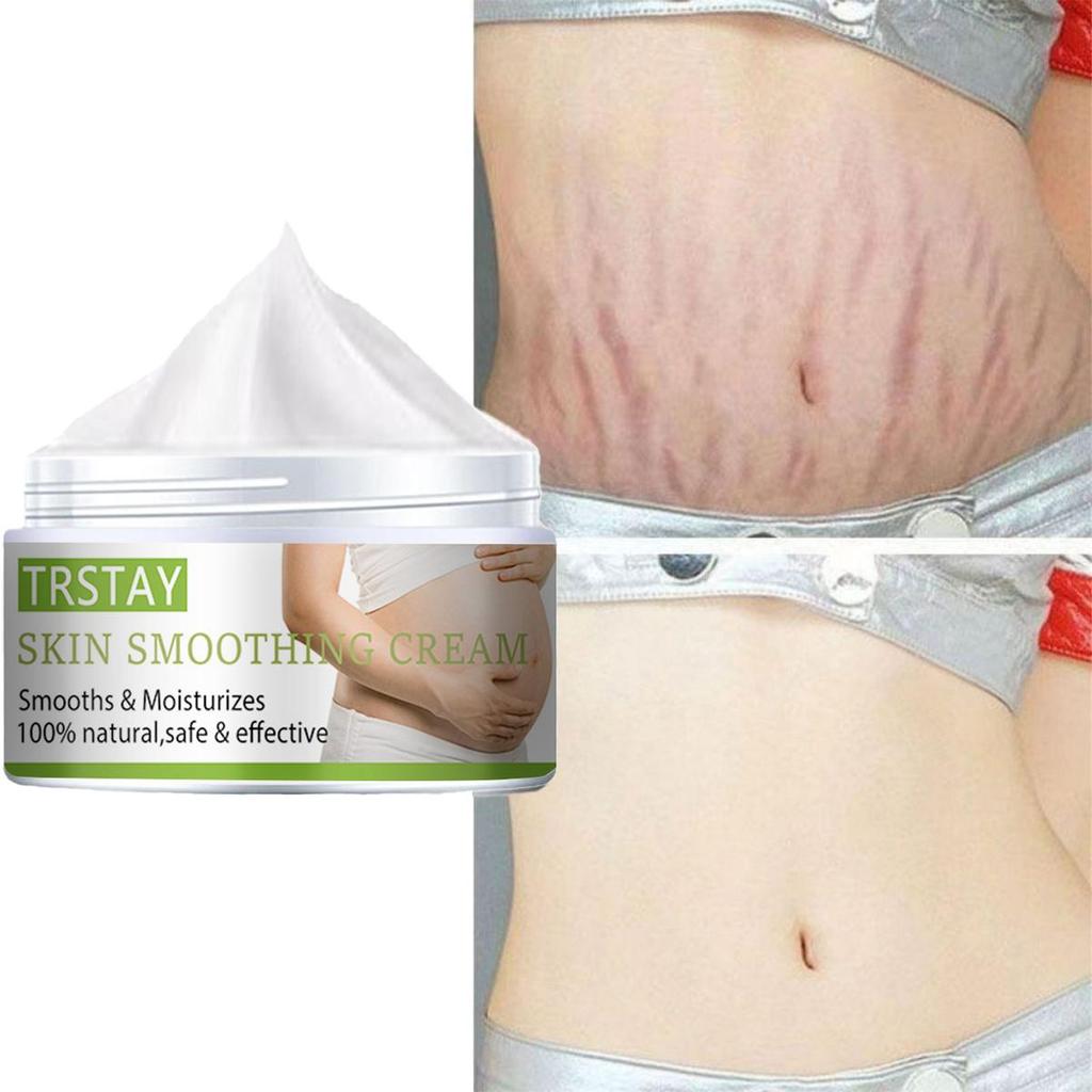 Stretch Mark Cream Pregnant Women Postpartum Stretch Marks  Crema Para Blanquear La Cara Skin Whitening Cream