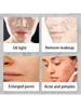 1pc Volcanic stone oil absorbing ball, cleanses the face, shrinks pores, absorbs oil, portable mini version oil removal