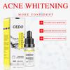 Oligopeptide Placenta Serum Whitening Face Cream Anti Aging Wrinkles Acne Essence Moisturizing