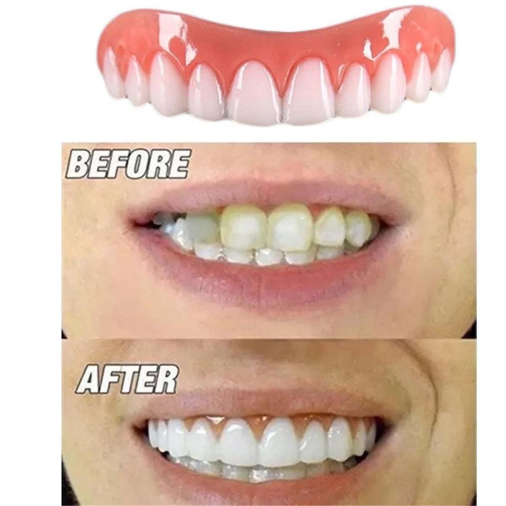 2 Pairs of Dentures, Prosthetic Teeth, Super Comfortable False Teeth, Perfect Fit, Flexible, Practical, Whitening Teeth, Natural and Comfortable Fit,