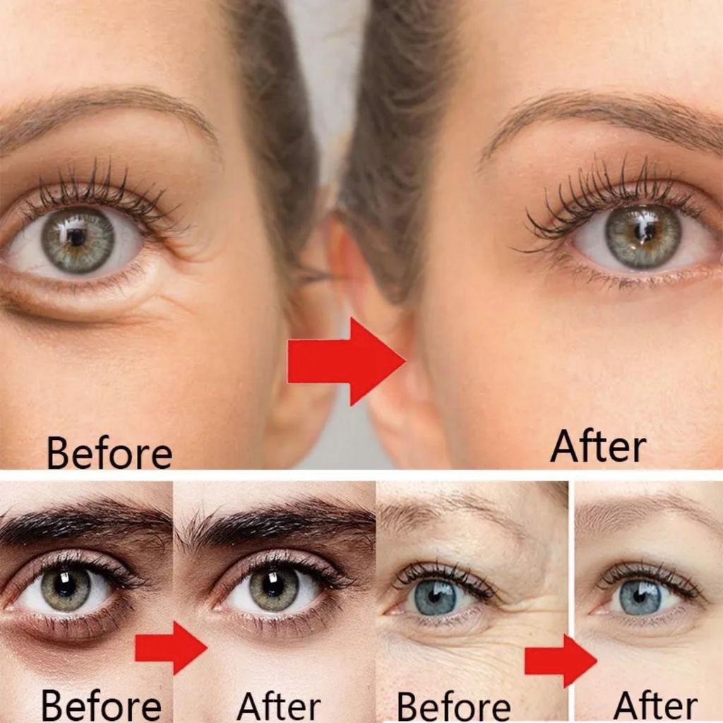 Eye Cream Adrenaline Strengthens and Cares for the Skin Around the Eyes, Whitening and Brightening the Skin, Hydrating and Moisturizing Eye Cream