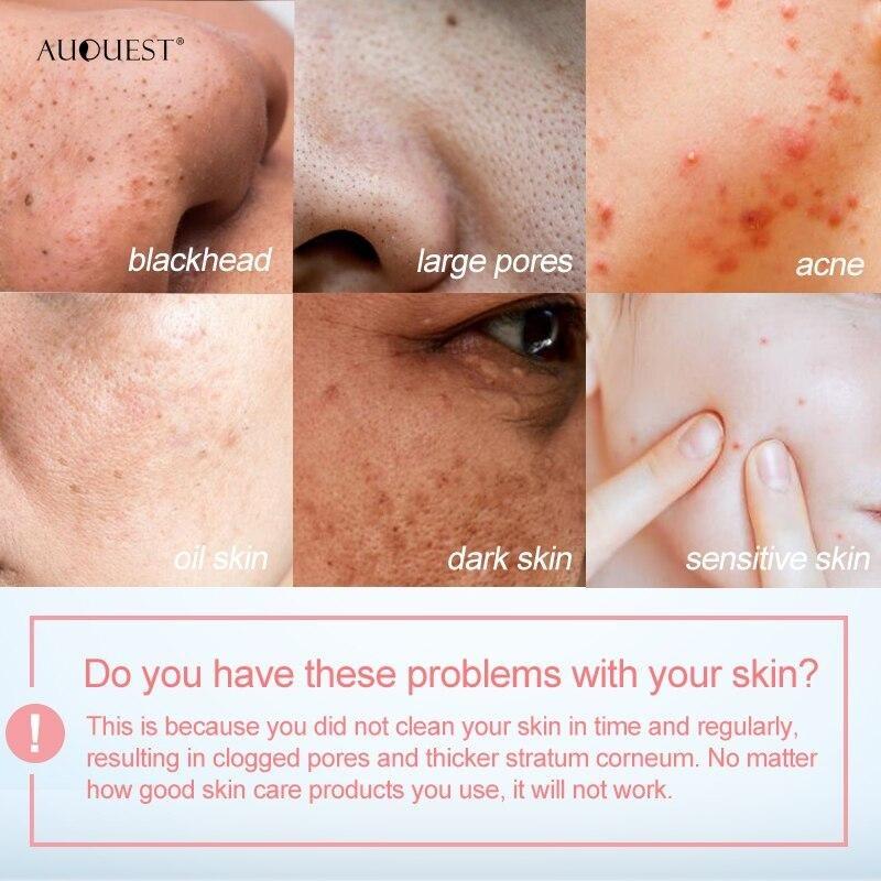 Face Cream Against Facial Acne Pores Blackhead Deep Cleansing Face Cream Whitening Exfoliating Facial Skin Care