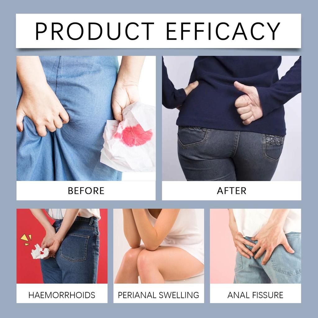 Hemorrhoids Soothing Ointment Mild Ingredients Body Comfort Care Anal Soothing Daily Care Ointment