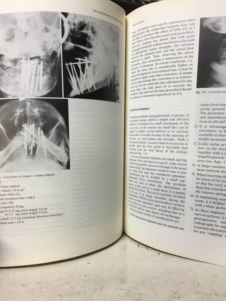 [USED] Hospital Disposal Book: The Radiotherapy of Malig, Large-format Medical Book
