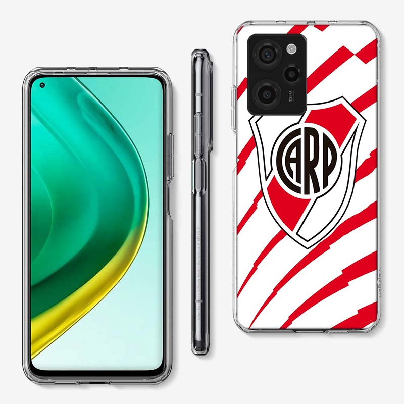 

Чехол для телефона R-River P-Plate My Madness and Passion Для Xiaomi Poco F7 Ultra X7 X5 X6 F6 Pro M5S M6 X3 X4 Mi 15 14 12T 11T 10T F5 Xiaomi Poco X6 Pro