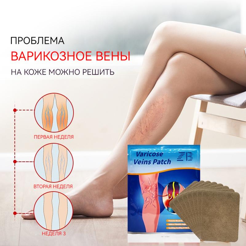 Varicose Veins Ease Plaster Chinese Herbal Patch For Veins To Enhance Capillary Health Care