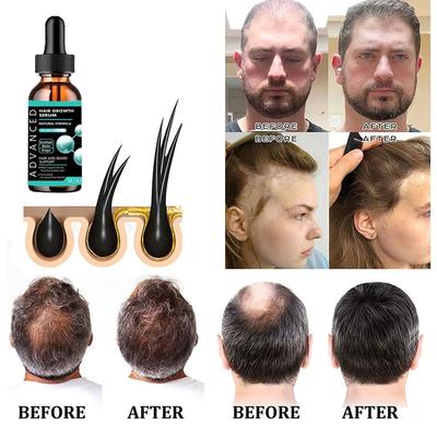 Película de queratina para cabello 100% natural, regulador profundo para reparar cabello teñido, reparar cabello dañado y fortalecer el cabello fino