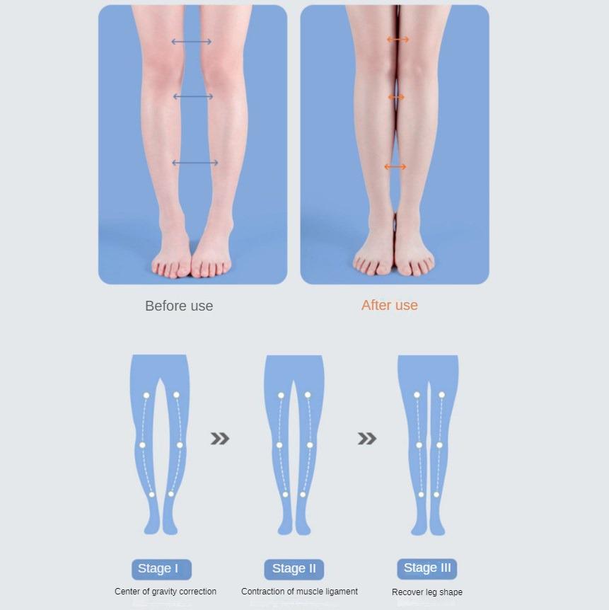 PU Orthotic Insole Arch Support Flat Foot Orthopedic Insoles for Shoes Women Men X/O Type Legs Valgus Feet Correction Shoe Pads