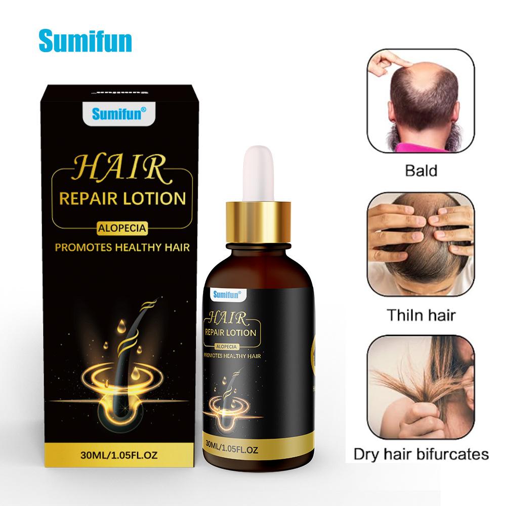30ml Hair Repair Essence, Anti-hair Loss Nourishing Liquid, Long Hair Nourishing Hairline, Multiflorum Multiflorum Hair Nourishing Essence