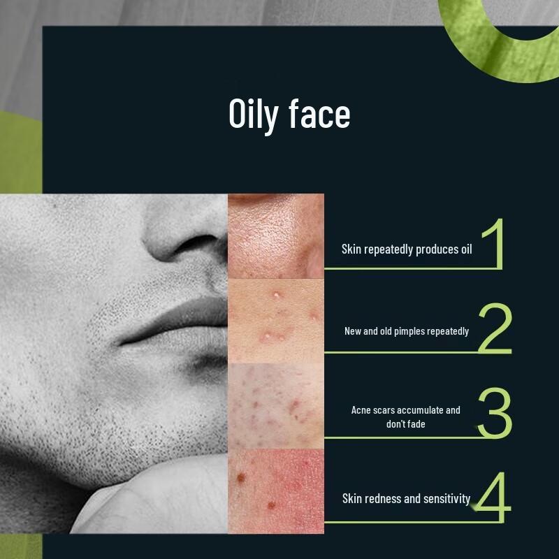 Mentholatum Men's Oil Control Acne Facial Cleanser