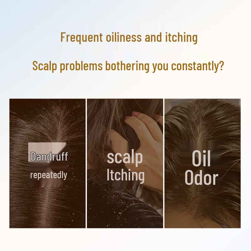 Bawang Ginger & He Shou Wu Anti-Dandruff Oil Control Shampoo