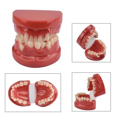 Dental Lab Teeth Malocclusion Model Demonstration Model for Training Studying Teaching Oral Model Dentistry Tools