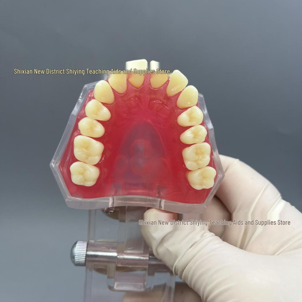 Transparent Dental Extraction Model with Removable Teeth and Soft Gums