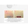 KOPHER - Curepair Melder Sos System Set