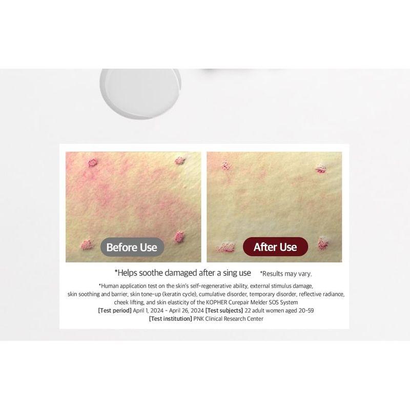 KOPHER - Curepair Melder Sos System Set