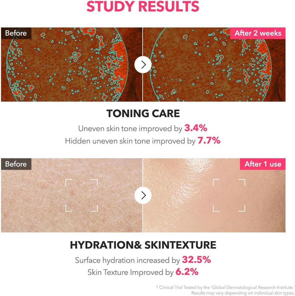 Aprilskin TXA Niacinamide 99 Milky Toner 150ml