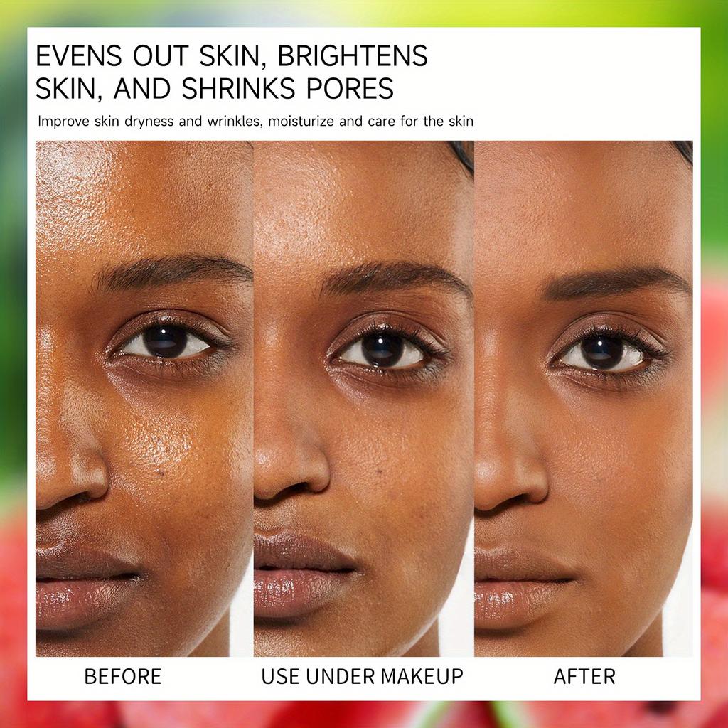 Watermelon Niacinamide Serum Facial Nourishing Moisturizing Small Bulb Serum Improve Facial Blemishes Serum 75ml