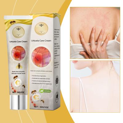 Multi-purpose Urticaria Care Cream, Deep Nourishing, Improve Urticaria To Reduce Redness And Itching