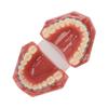 Dental Orthodontic Model 28pcs Teeth Resin Dental Teaching Teeth Model with Metal Braces