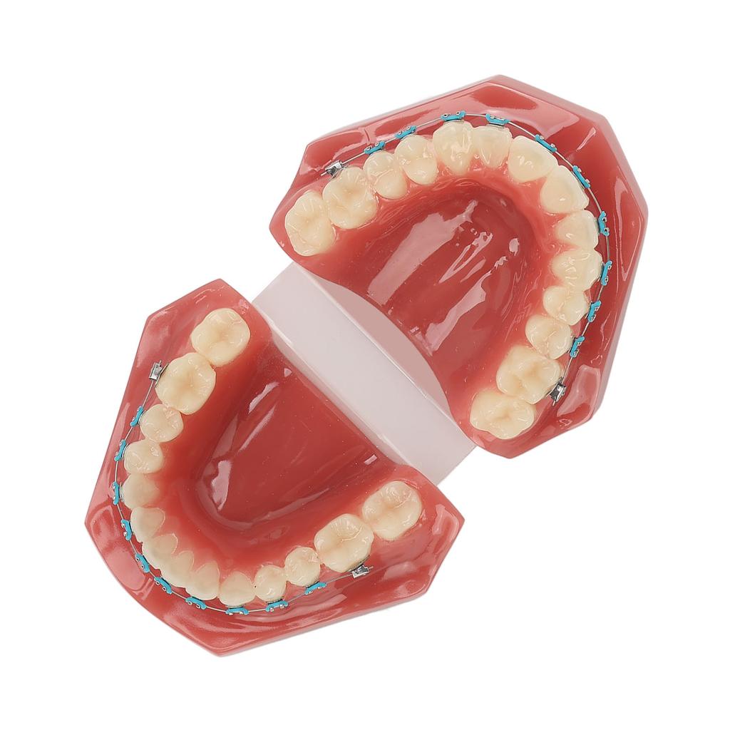 Dental Orthodontic Model 28pcs Teeth Resin Dental Teaching Teeth Model with Metal Braces