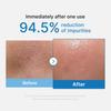 medicube Zero Pore Blackhead Cleansing Oil | Makeup Remover for all skin types, Daily Moisture Facial Cleanser, Low-Irritation | K