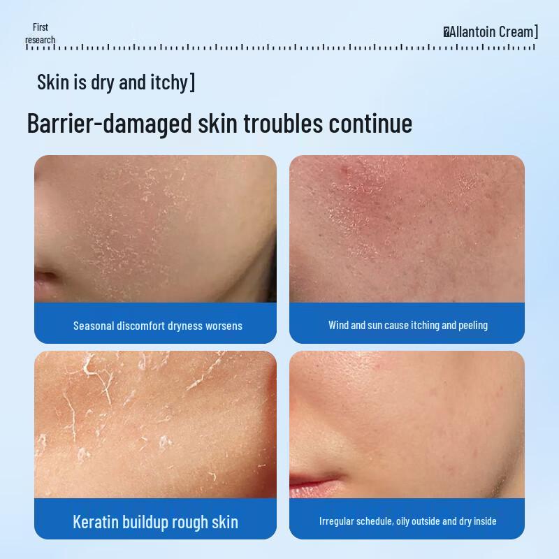 Shouyan Allantoin Moisturizing Cream 40g