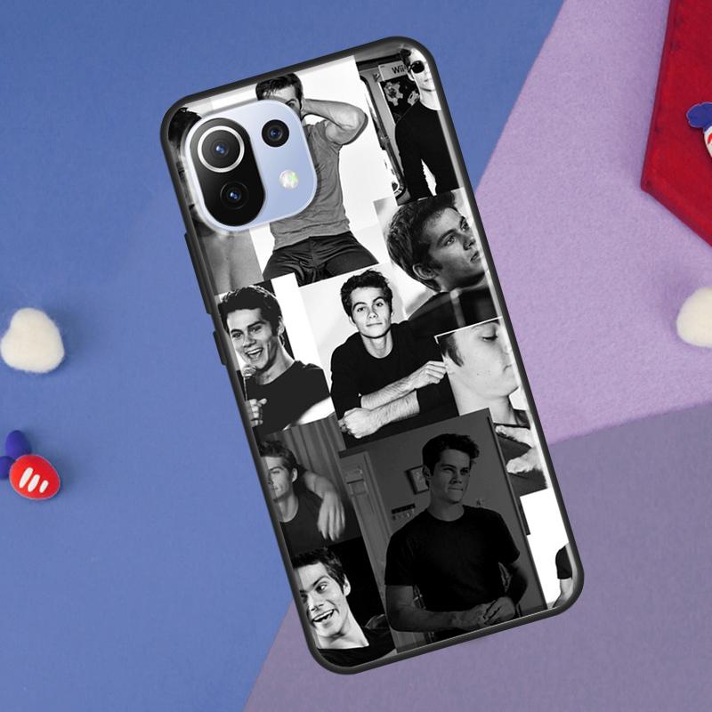 Dylan O'Brien Teen Wolf Cover For Xiaomi 14 Ultra 13 11T 12T 13T 14T Pro POCO X6 X7 Pro X3 X5 F3 F5 F6 M6 Pro Case