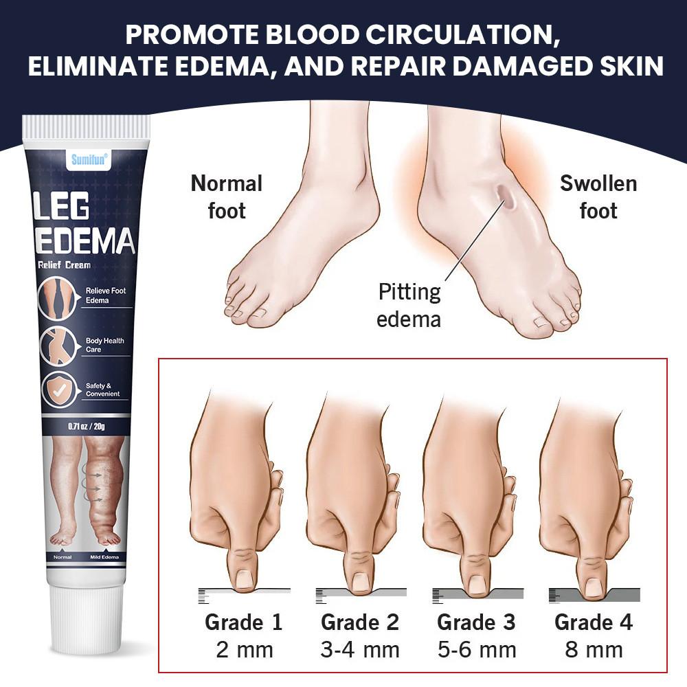 Gel Sollievo Ritenzione Idrica Gambe Per Riduzione Gonfiore E Circolazione Sana