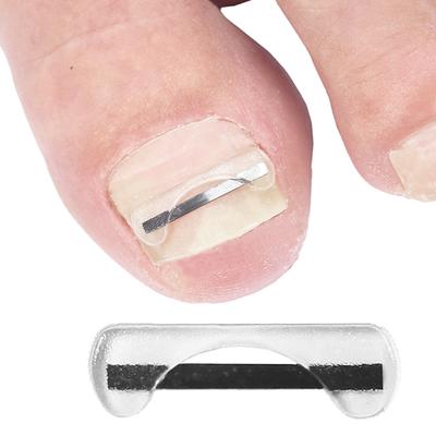 Alambre de Corrección de Uñas del Pie de Aleación de Titanio Dispositivo de Tratamiento para Uñas Encarnadas Pegatinas Herramienta de Silicona Accesorios para el Cuidado de los Pies Uso Diario
