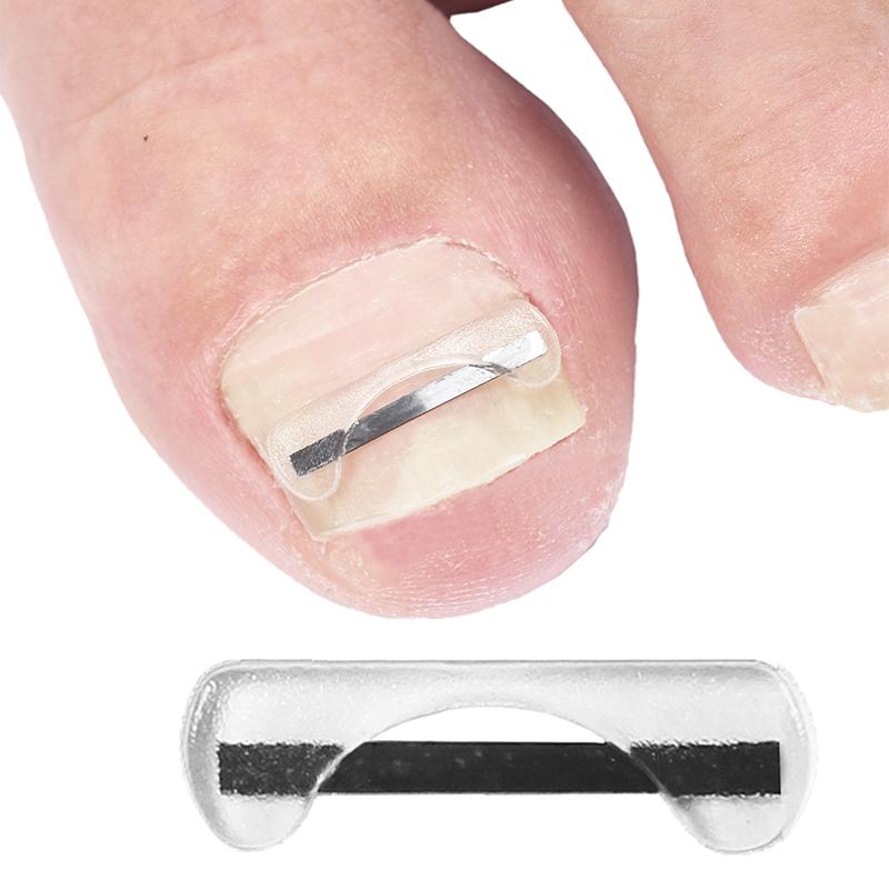Titanium Alloy Toenail Correction Wire Ingrown Nail Treatment Device Stickers Silicone Tool Foot Care Accessories Daily Use