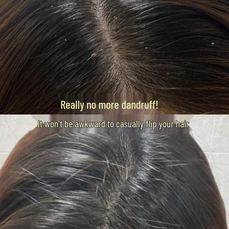 Spes Bisabolol Polypeptide Softening Hair Conditioner Gift Set