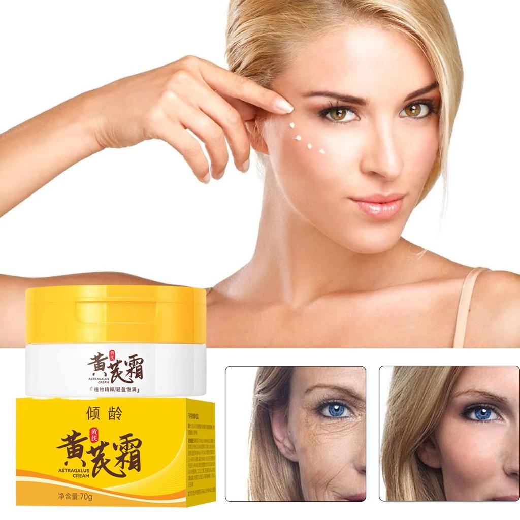Chinese Astragalus Whitening Freckles Cream Remove Lightening Brighten Dark Spot Dry Face Care R8V8
