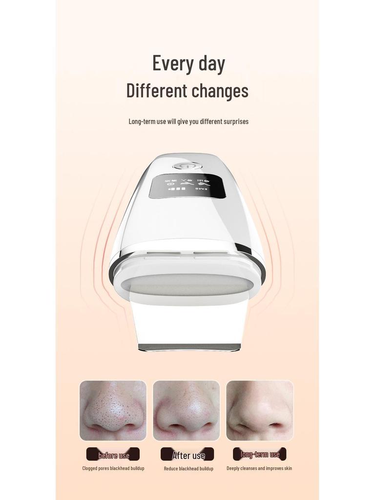 Ultrasonic Skin Scrubber & Blackhead Remover: Beauty Instrument for Facial Pores, Blackhead Suction, and Skin Peeling.