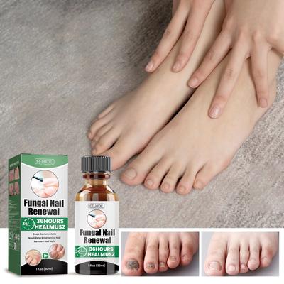 Nail Treatment Nail Treatment Nail Treatment Nail Treatment 3 Days Effect Nail Care Oil