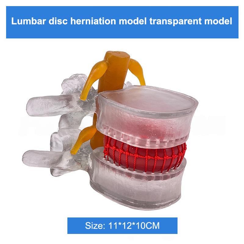 Profession Lumbar Model Human Anatomy Skeleton Spine Lumbar Disc Herniation Teaching Model Demonstration Model Teaching Model прозрачный