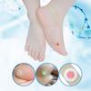 Foot Corn Removal Killer Calluses Plantar