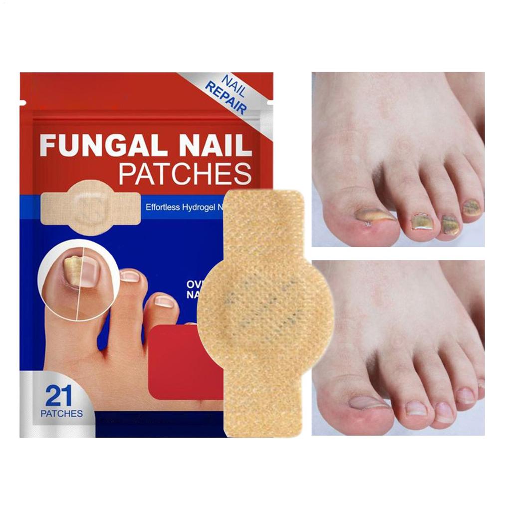 NailFungus Patch Waterproof Nail Repair Patch Ingrown Correction Sticker Damaged Nail Gray Care Patch Feet Care Tools