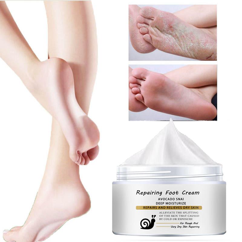 Repair Foot Cream for chapped, broken hands/heels, natural essence cream, gentle and non-irritating